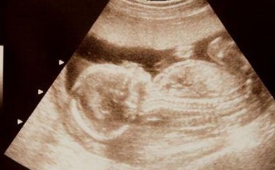 福州有名老中医看不孕不育（福州有名老中医看不孕不育的医生）