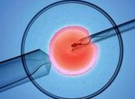 在试管婴儿取卵后出现腹水怎么办？